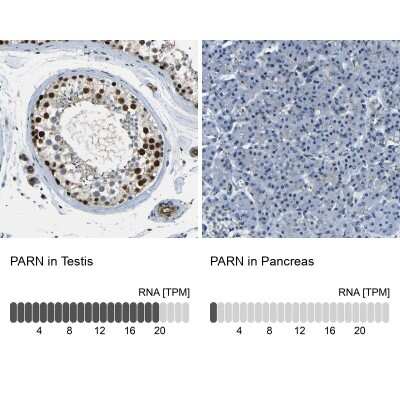 Immunohistochemistry-Paraffin: PARN Antibody [NBP1-84303]