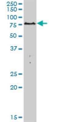Western Blot: PARN Antibody [H00005073-B01P]