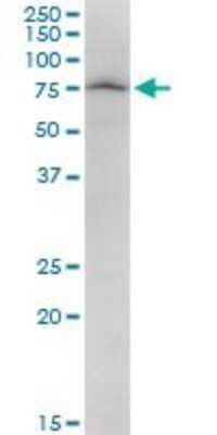 Western Blot: PARN Antibody [H00005073-B01P]