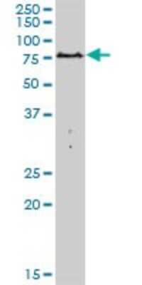 Western Blot: PARN Antibody [H00005073-B01P]