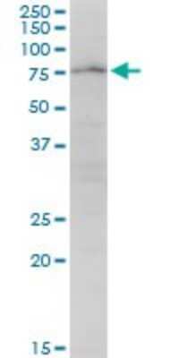 Western Blot: PARN Antibody [H00005073-B01P]