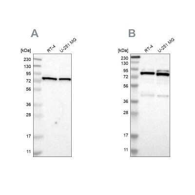 Western Blot: PARN Antibody [NBP1-84303]