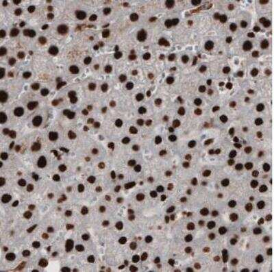 Immunohistochemistry-Paraffin: PARP Antibody (CL2209) [NBP2-36748]