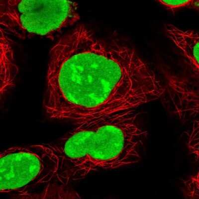 Immunocytochemistry/ Immunofluorescence: PARP Antibody [NBP2-13732]