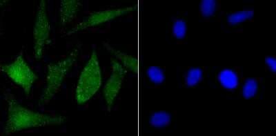 Immunocytochemistry/ Immunofluorescence: PARP Antibody [NBP3-09070]