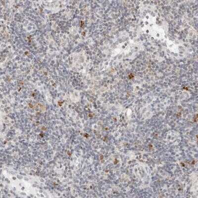 Immunohistochemistry-Paraffin: PARP10 Antibody [NBP1-83689]