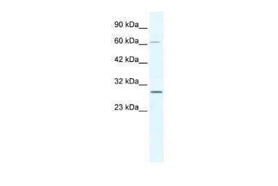 Western Blot: PARP11 Antibody [NBP2-85441]
