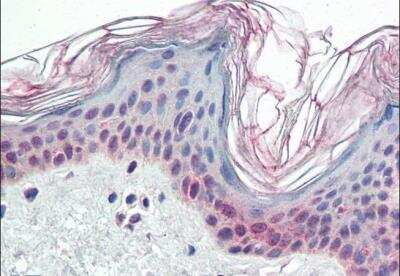 Immunohistochemistry-Paraffin: PARP2 Antibody [NB100-2556]
