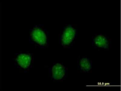 Immunocytochemistry/ Immunofluorescence: PARP3 Antibody [H00010039-B01P]