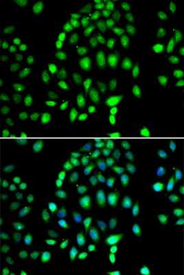 Immunocytochemistry/ Immunofluorescence: PARP3 Antibody - BSA Free [NBP2-93033]