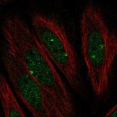 Immunocytochemistry/ Immunofluorescence: PARP3 Antibody [NBP3-17288]