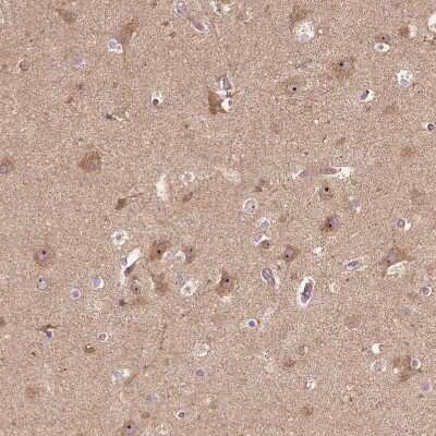 Immunohistochemistry-Paraffin: PARP3 Antibody [NBP2-49523]