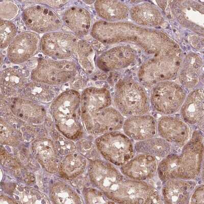 Immunohistochemistry-Paraffin: PARP3 Antibody [NBP2-49523]