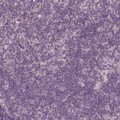 Immunohistochemistry-Paraffin: PARP3 Antibody [NBP2-49523]