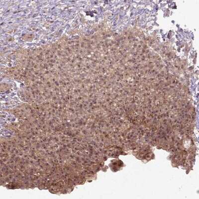 Immunohistochemistry-Paraffin: PARP3 Antibody [NBP2-49523]