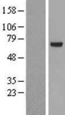 Western Blot: PARP3 Overexpression Lysate [NBL1-14117]