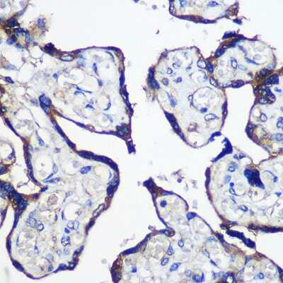 Immunohistochemistry-Paraffin: PARP8 Antibody - Azide and BSA Free [NBP2-93551]
