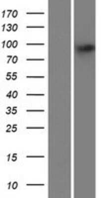 Western Blot: PARP8 Overexpression Lysate [NBP2-06315]