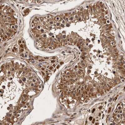 Immunohistochemistry-Paraffin: PARS2 Antibody [NBP1-84105]