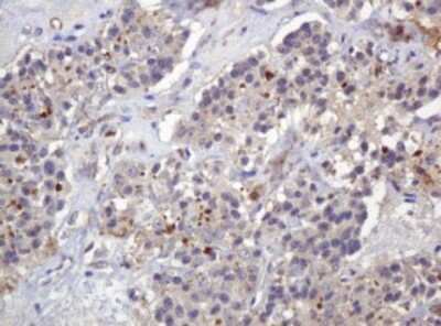 Immunohistochemistry: PARVB Antibody (OTI1B7) [NBP2-46327]