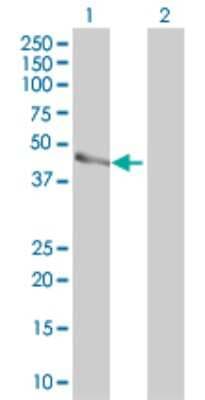 Western Blot: PARVB Antibody (4A11) [H00029780-M01]