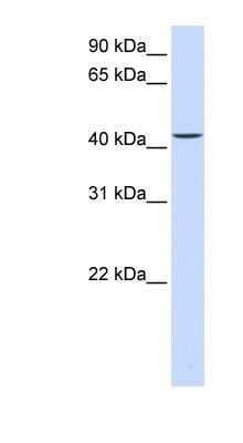 Western Blot: PARVB Antibody [NBP1-59135]