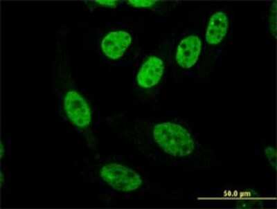 Immunocytochemistry/ Immunofluorescence: PASD1 Antibody (3C1) [H00139135-M08]