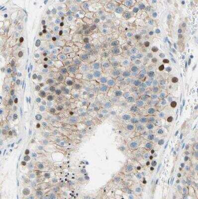 Immunohistochemistry-Paraffin: PASD1 Antibody [NBP1-84346]