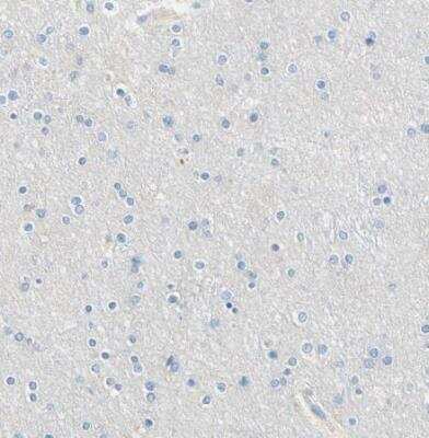 Immunohistochemistry-Paraffin: PASD1 Antibody [NBP1-84346]