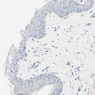 Immunohistochemistry-Paraffin: PASD1 Antibody [NBP1-84346]