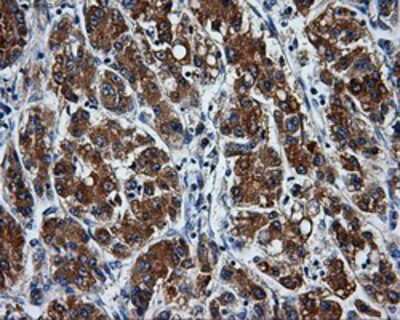 Immunohistochemistry-Paraffin: PASK Antibody (OTI8G9) [NBP2-02242]