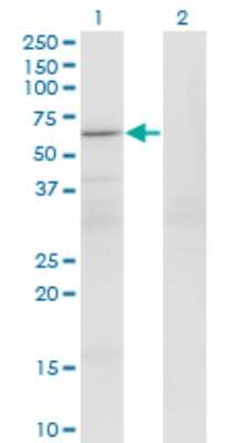 Western Blot: PATZ Antibody (1B2) [H00023598-M01]