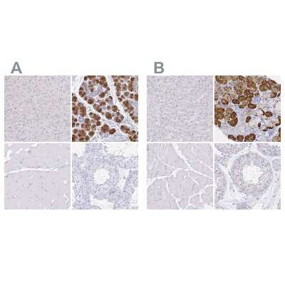 Immunohistochemistry-Paraffin: PAUF/ZG16B Antibody [NBP1-81699]