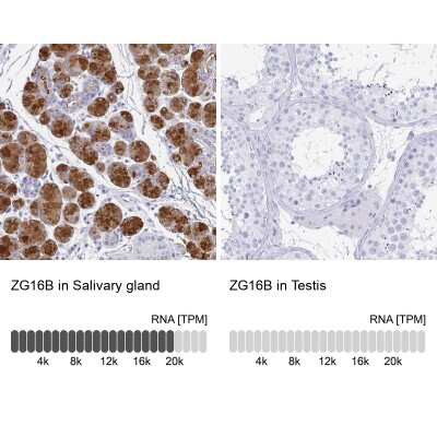 Immunohistochemistry-Paraffin: PAUF/ZG16B Antibody [NBP1-81699]