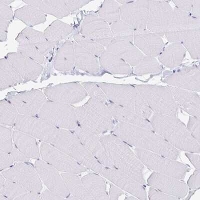 Immunohistochemistry-Paraffin: PAUF/ZG16B Antibody [NBP1-81699]