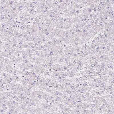Immunohistochemistry-Paraffin: PAUF/ZG16B Antibody [NBP2-49089]
