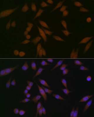 Immunocytochemistry/ Immunofluorescence: PAWR / PAR4 Antibody (10Q2G9) [NBP3-16523]