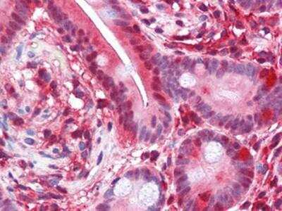 Immunohistochemistry-Paraffin: PAWR / PAR4 Antibody (3G9H7) - BSA Free [NBP1-28892]