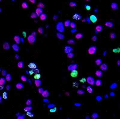 Immunohistochemistry: PAX8 Antibody (1F8-3A8) [NBP2-29903]