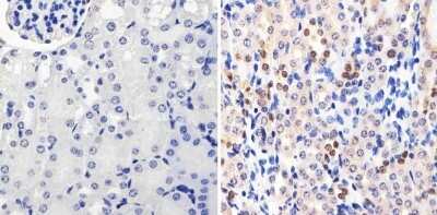 Immunohistochemistry-Paraffin: PAX8 Antibody (1F8-3A8) [NBP2-29903]