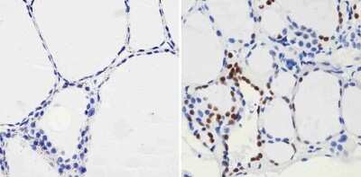 Immunohistochemistry-Paraffin: PAX8 Antibody (1F8-3A8) [NBP2-29903]