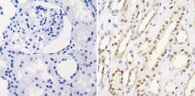 Immunohistochemistry-Paraffin: PAX8 Antibody (1F8-3A8) [NBP2-29903]
