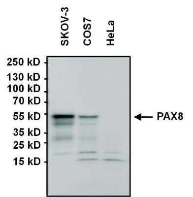 Western Blot: PAX8 Antibody (1F8-3A8) [NBP2-29903]