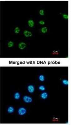 Immunocytochemistry/ Immunofluorescence: PAX8 Antibody [NBP1-32440]