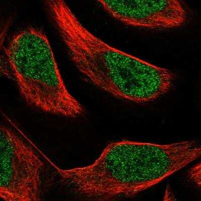 Immunocytochemistry/ Immunofluorescence: PAX8 Antibody [NBP1-89436]