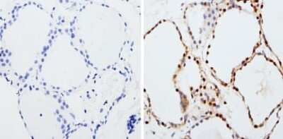 Immunocytochemistry/ Immunofluorescence: PAX8 Antibody [NBP2-29907]