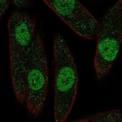 Immunocytochemistry/ Immunofluorescence: PAX8 Antibody [NBP2-56890]