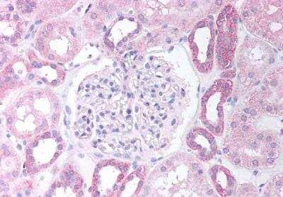 Immunohistochemistry-Paraffin: PAX8 Antibody [NB100-1065]