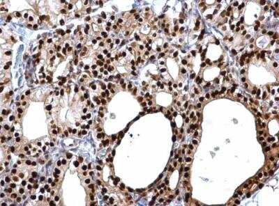 Immunohistochemistry-Paraffin: PAX8 Antibody [NBP1-32440]