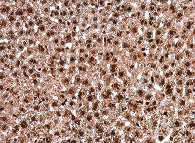 Immunohistochemistry-Paraffin: PAX8 Antibody [NBP1-32440]